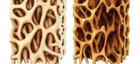 impianti dentali osteointegrazione