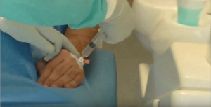 implantologia a carico immediato prezzi video foto paziente dal vivo