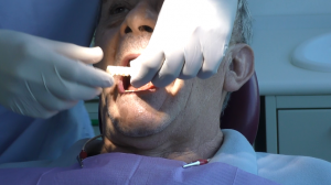 impianti dentali a carico immediato